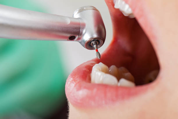 Best Emergency Gum Treatment in Flourtown, PA